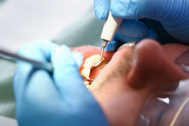 Best Dentist for Tooth Abscess  in Blue Island, IL